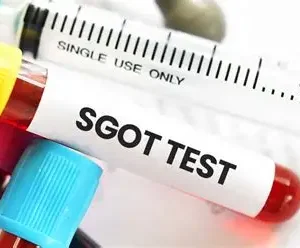 SGOT
